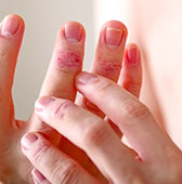 アトピー性皮膚炎でこんなお悩みありませんか？